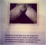 Forrest Bess "Documentation on his genital surgery", Bienal 2012 Museo Whitney  